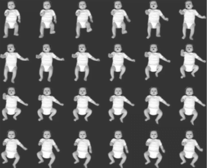 Imagens dos movimentos espontâneos/irregulares em um bebê de 14 semanas (<a href="https://www.scielo.br/scielo.php?script=sci_arttext&amp;pid=S0021-75572016000400064">Einspieler et al, 2016</a>)